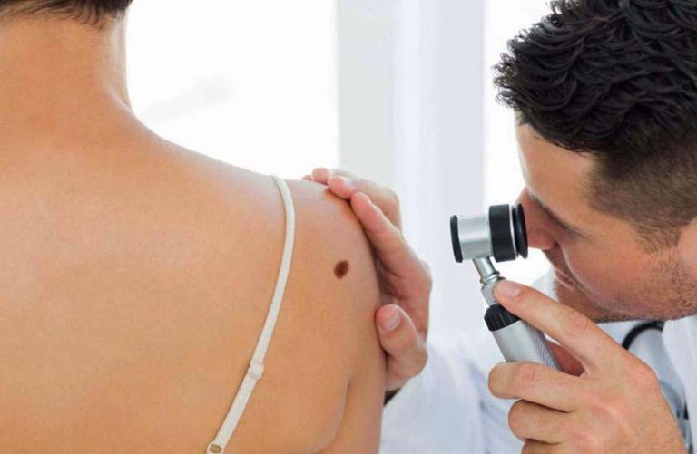 CIDOCS DINORAH BATIZ SOBRE CANCER DE PIEL (10)