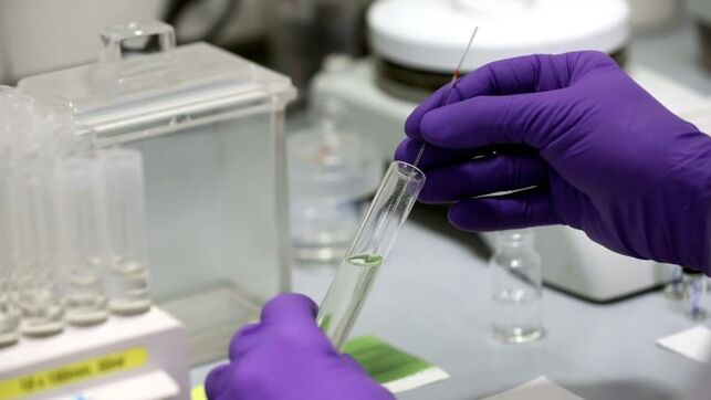 ensayo-clinico-europeo-tratamientos-COVID-19_EDIIMA20200322_0259_4