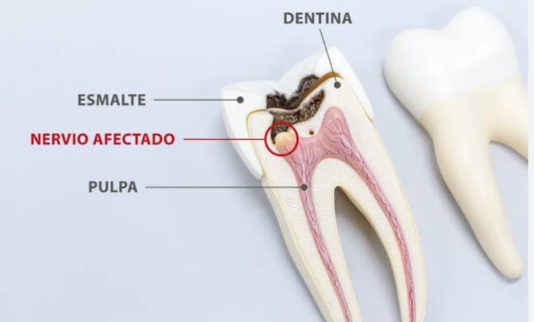 ENDODONCIA (1)