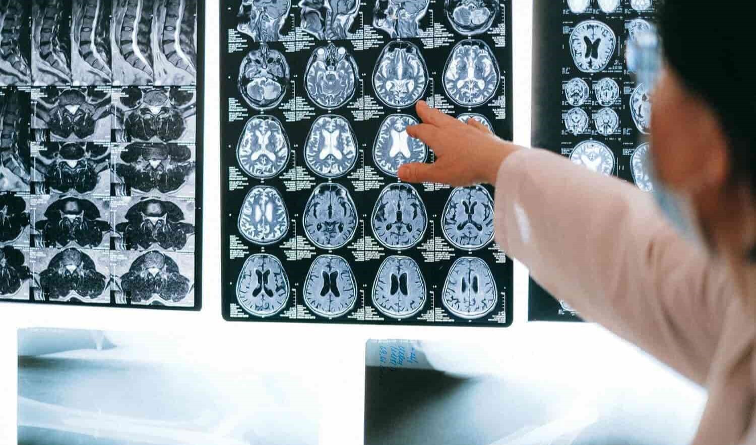 traumatismo craneoencefalico