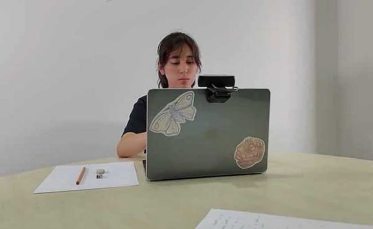 unas