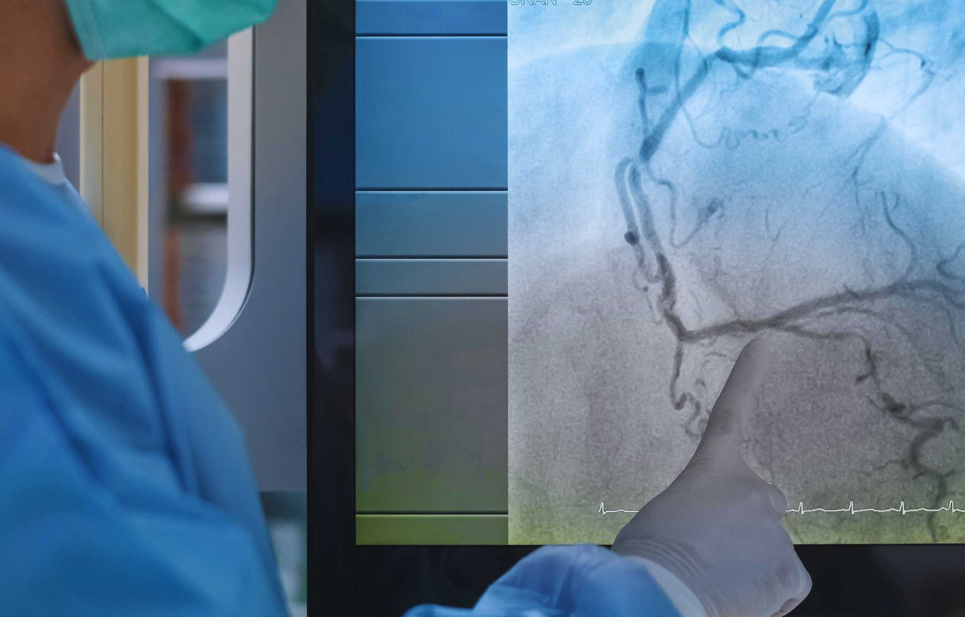 Angiograma Cardíaco en Puerto Vallarta - 1